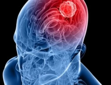 Μηνιγγίωμα στο κεφάλι: Μην αδιαφορήσετε σε αυτά τα συμπτώματα – Τι θα νιώσετε αν σας συμβεί